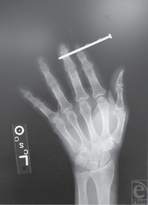 Not Rob's co-worker's hand – an x-ray of an anonymous dude’s hand from the National Medical Library.